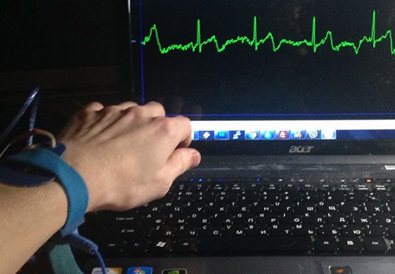 Украинские разработчики анонсировали создание уникального кардиобраслета