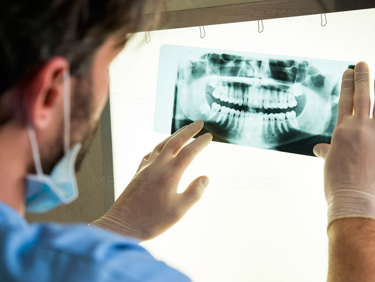 Рентгеновские снимки зубов: какие они бывают?
